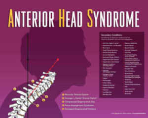Benefits of Chiro