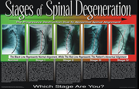 Treatment Options